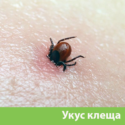 Укус клеща в Ялте